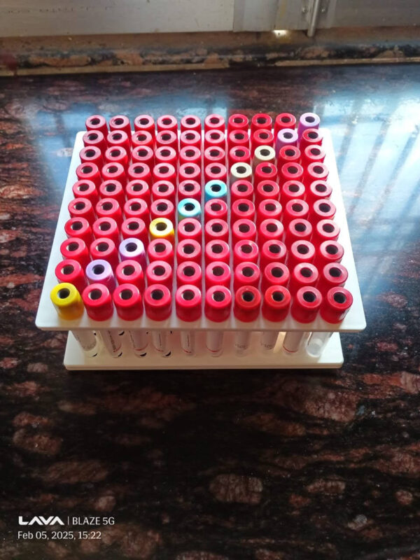 Test Tube Rack, 100 Wells for Blood Collection Tubes Autoclavable